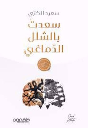 صورة سعدت بالشلل الدماغي   -  سعيد الكتبي